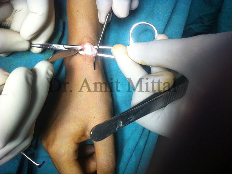 Best Urologist in Jaipur